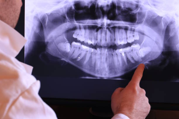 Best Knocked-Out Tooth Emergency  in Wyoming, PA